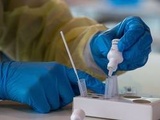 Coronavirus : Des chercheurs découvrent en Belgique le cas d’une femme contaminée simultanément par deux variants