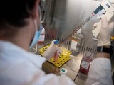 Coronavirus : Le tocilizumab réduit la mortalité, confirme une vaste étude