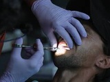 Marseille : « Le docteur Guedj m'a percé les dents à vif, sans m'endormir », témoigne une victime du dentiste accusé de mutilations dentaires